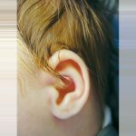 נוזלים באוזניים